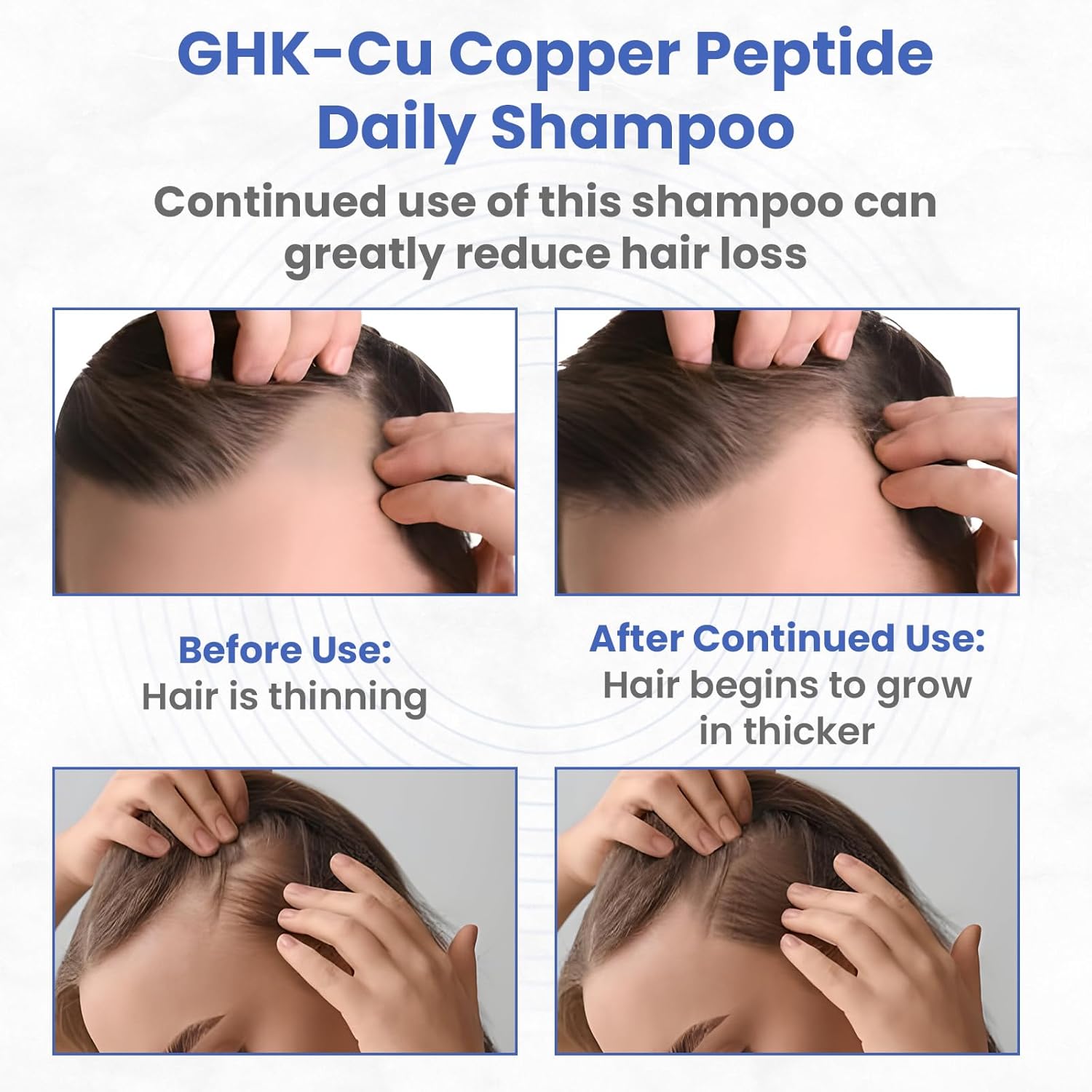 GHK-Cu Copper Peptide Shampoo - Anti Hair Loss Shampoo - Promotes New Hair Growth, 11.8 Fluid Ounce
