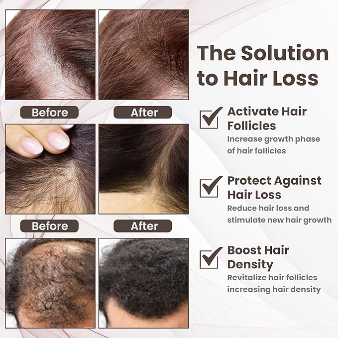 Copper Peptide Hair Growth Treatment Serum, GHK-Cu and AHK-Cu, Licorice Extract,1oz