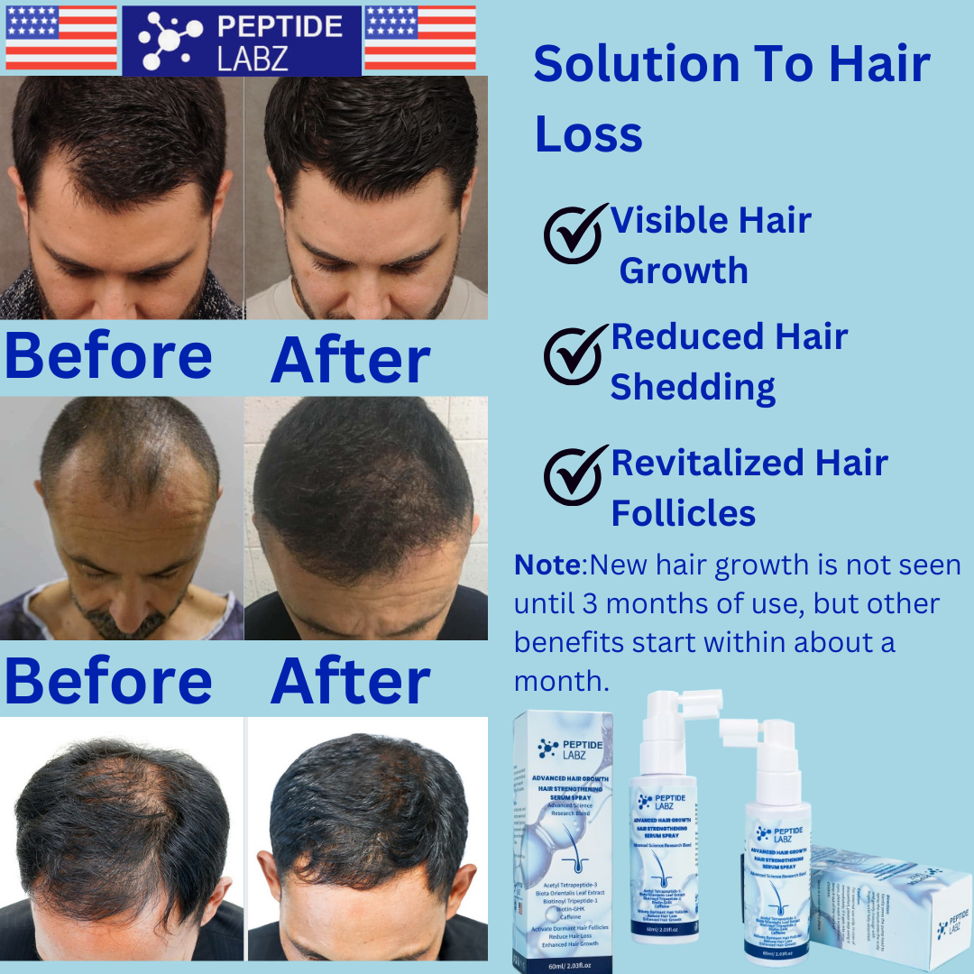 Hair Growth Serum Spray with Peptides, Acetyl Tetrapeptide-3, Biotin-GHK, Licorice Root Extract and Caffeine